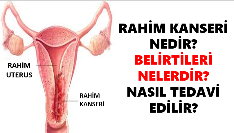 Photo of Rahim Kanseri Belirtisi?